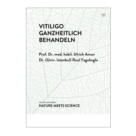 Vitiligo
